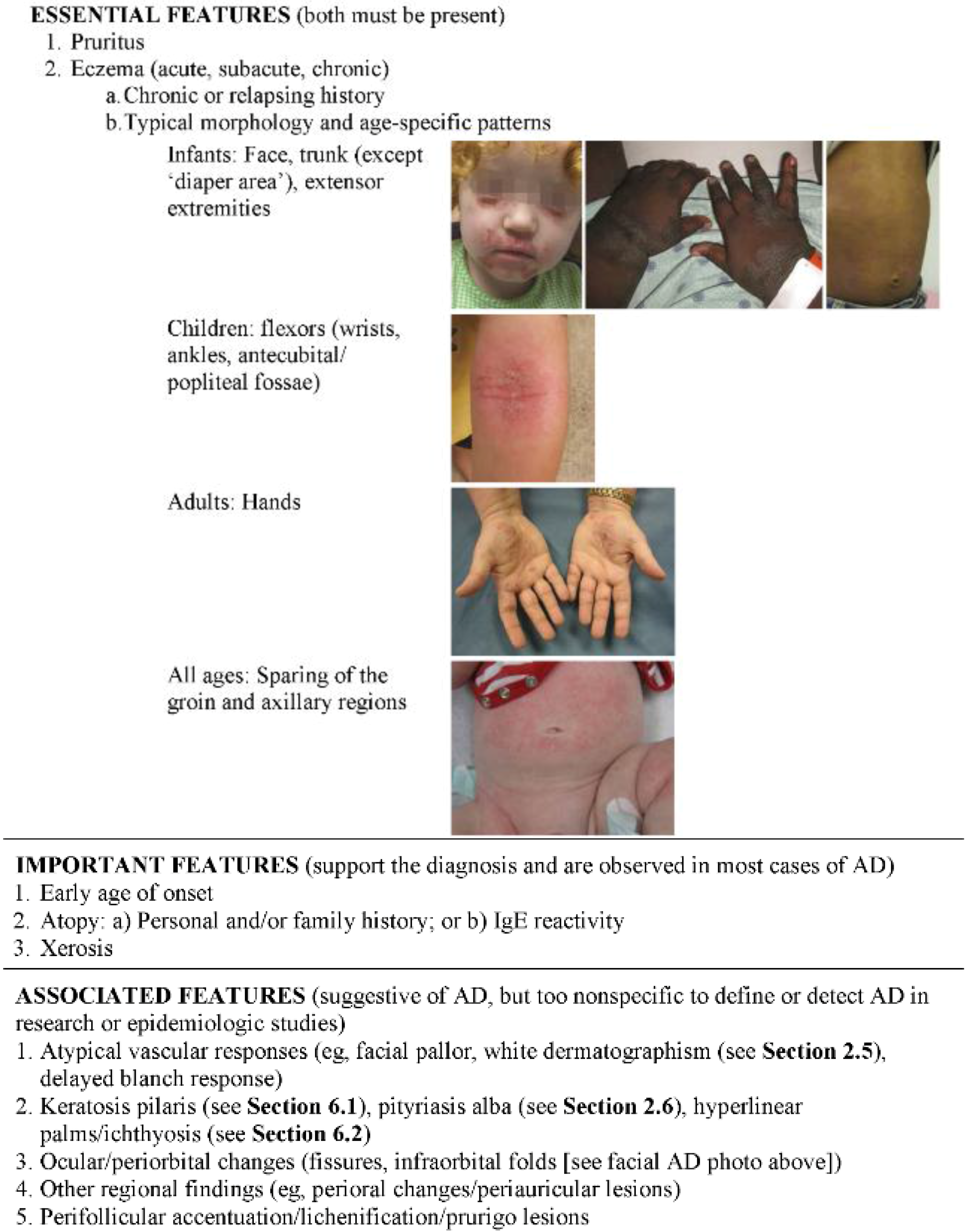 American academy of dermatology guideline atopic dermatitis